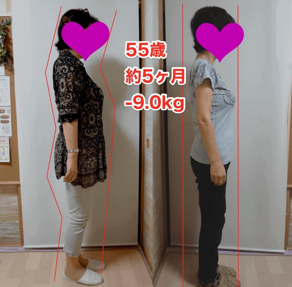 東京都在住 55歳 耳つぼダイエットで 痩せたのに若くなったと言われます