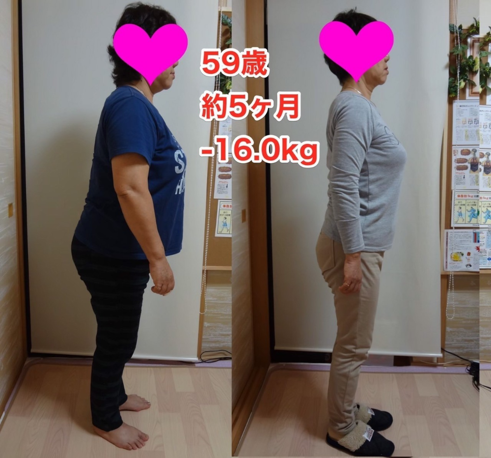 運動苦手!59歳! 膝が痛くて運動できません! リバウンドどころか 卒業後も自力でー5kg